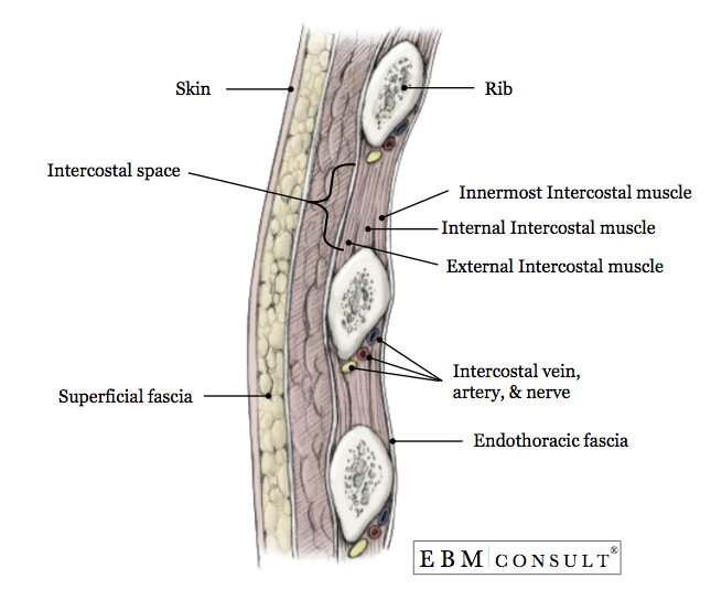 Chest Tube Placement Thoracostomy Procedure